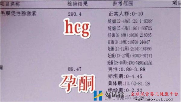 通过试管婴儿移植后多久可以验孕验孕成功后多久可以测胎心(图1) 通过试管婴儿移植后多久可以验孕验孕成功后多久可以测胎心(图1)