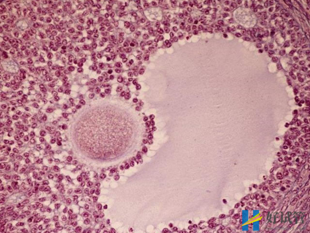 备孕遇上卵泡不破综合症别紧张,这4个治疗办法赶快收下(图1) 卵泡发育成熟后会自动排除