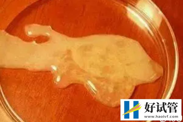 谁说取卵后医生不会发告知胚胎质量的短信,咋样看完就造(图2) 精子生命力有限