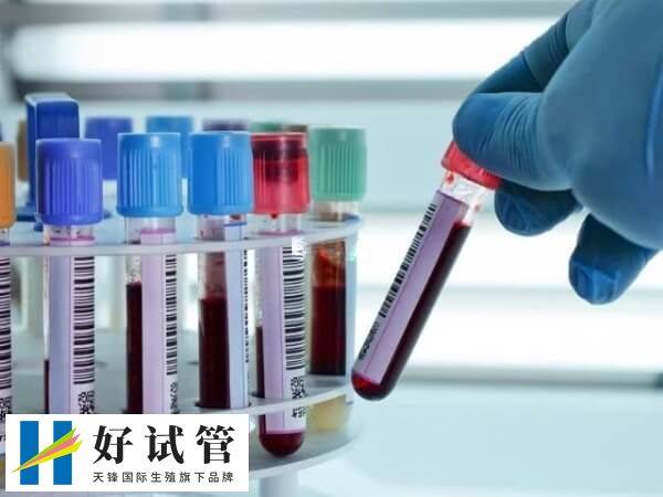 试管移植14天要抽血检查hcg数值