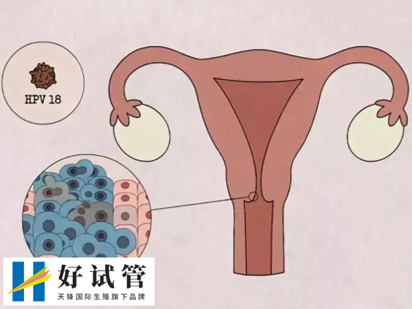 血沉检查对试管婴儿成功率可能有影响