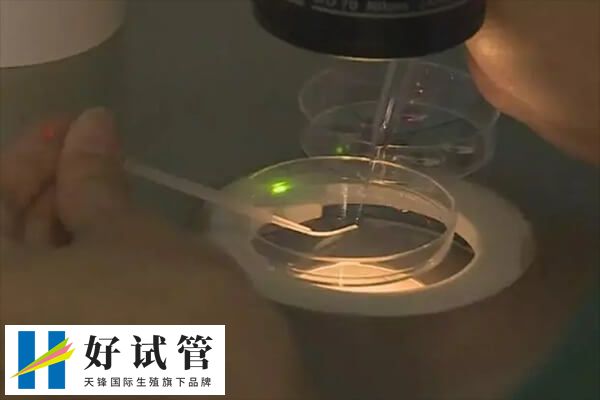 试管促排是一种常见的辅助生殖技术