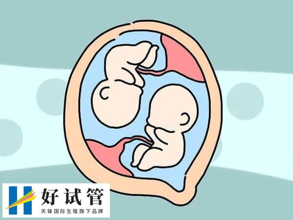 做试管龙凤胎大约多少钱一次(图2) 胚胎是男性或女性也是一个随机事件