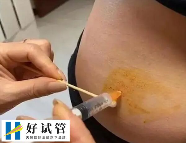 达必佳打完肚子鼓了个包能被吸收掉吗?(图1) 打达必佳的时候要缓慢推动药物