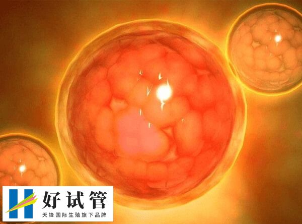 多发性骨软骨瘤做试管婴儿会不会遗传(图2) 骨髓瘤病例中最常见的发病年龄是65岁左右