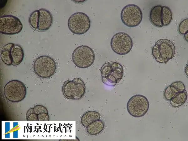取卵后的第三天还是第七天是腹水高峰期呢？(图2)
